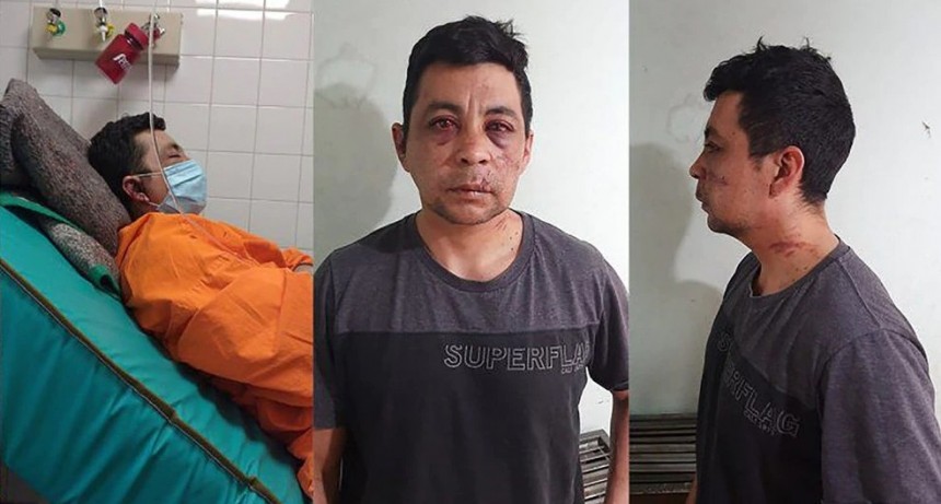 Murió el enfermero neuquino que fue atacado por sus vecinos cuando se contagió de COVID-19: “Nunca se recuperó del rechazo social”