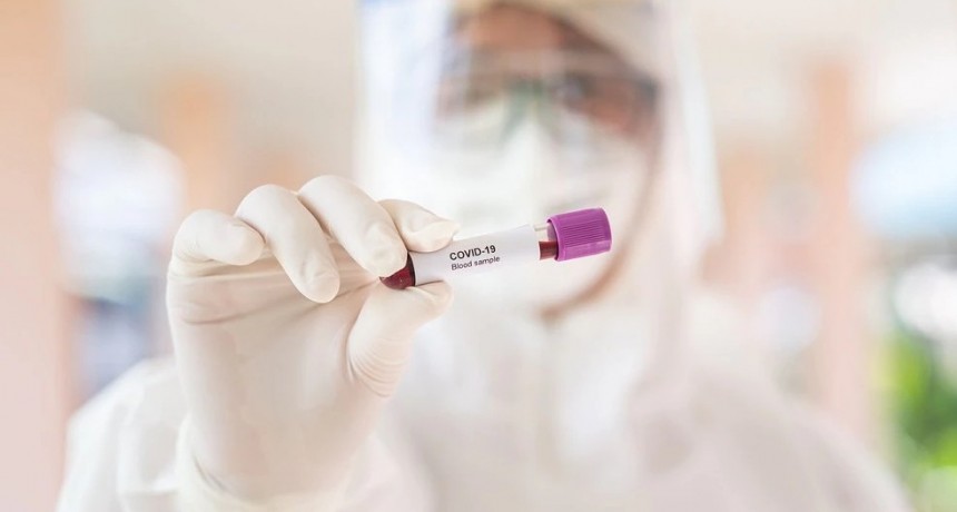 Tests de anticuerpos contra el coronavirus: por qué algunas personas obtienen resultados tan bajos y otras tan altos